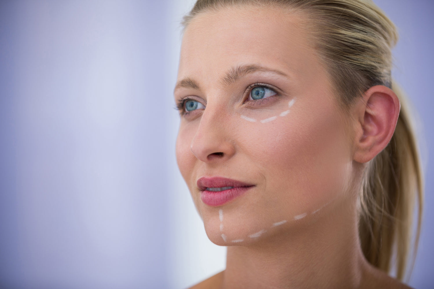 Décoder l’acné grâce au face mapping : ce que votre peau vous révèle